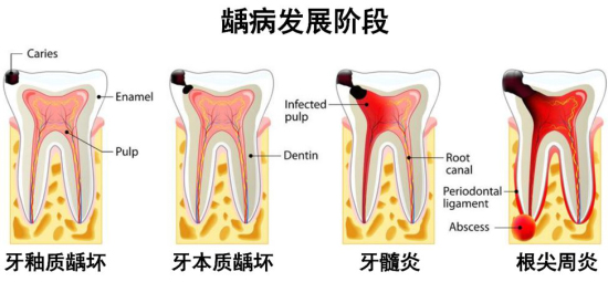 疫情时期如何正确预防及应对口腔急诊问题新闻资讯 四川大学华西口腔医学院